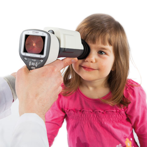 optomed smartscope pro