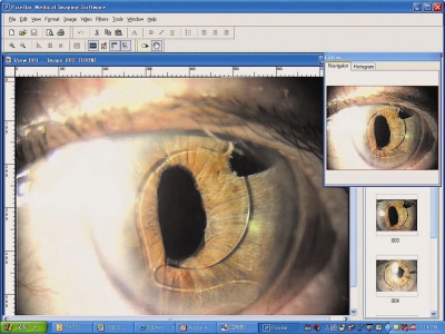 Database Software - Standard with Pro-Pix 
